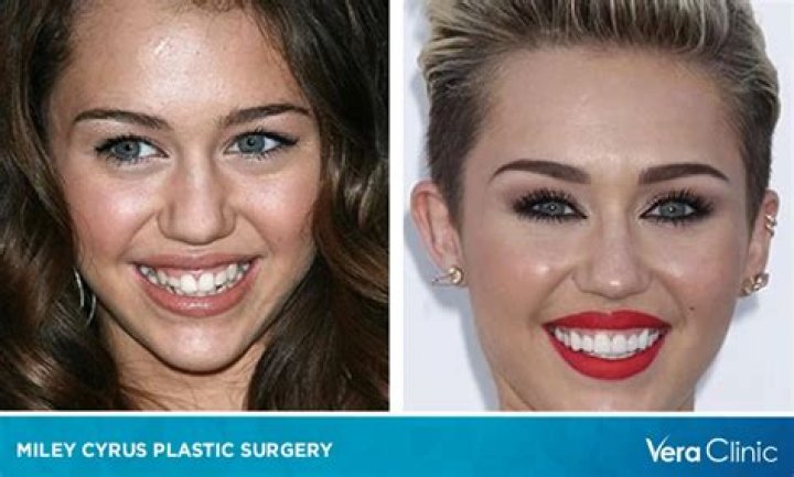 Tish Cyrus Plastic Surgery Before And After